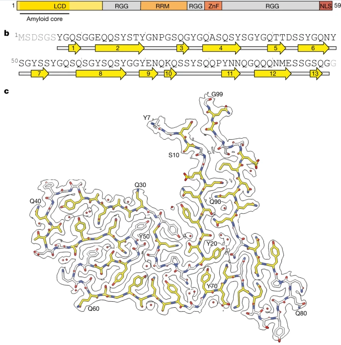 Nature：科學家識別出與人類額顳葉癡呆癥發(fā)生相關(guān)的新型蛋白質(zhì)